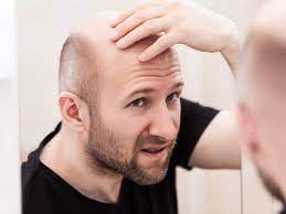 Before answering the following recurrent query: Hair Loss Treatment Medicines For Hair Fall And Hair Regrowth Times Of India