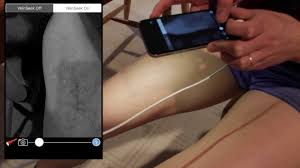 ✅our handheld vein detector device is the affordable portable vein finder for general vein access in adults and children. Veinseek And Veinscanner