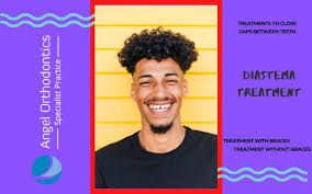 Movement of teeth into existing gaps is also the result of a natural process called mesialization which means that teeth have the tendency to come forward. Diastema Treatments To Close Gaps Between Teeth Angel Orthodontics