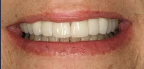 Bu işletme için google ve bing dahil 2 sosyal paylaşım sayfası, saat, telefon, web sitesi ve daha fazlasını gör. Gallery Dentist In Westford Ma