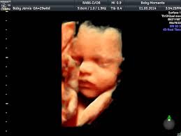 Pin On 3d 4d Baby Scans Www Scan4d Co Uk