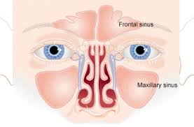 sinus infection sinusitis cleveland clinic