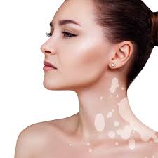 Isispharma Nicaragua