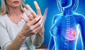 Breast cancer is most easily treated if spotted early. Breast Cancer Symptoms And Signs Watch Out For Swelling In Your Arm Or Hand Express Co Uk