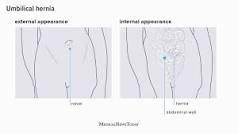 Image result