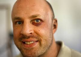 Ex-Cheyenne lawmakerfights in MMA match