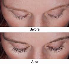 Before And After Eyelash Growth How To Grow Eyelashes Eyelash Growth Treatment Beauty Hacks
