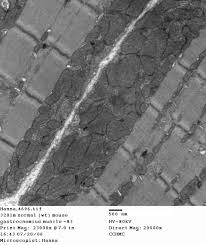 Image result for Grey 1997 CIL