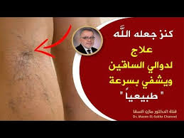 كنز جعله الله علاج دوالي الساقين ويشفي بسرعة طرق طبيعية لمحاربة الأوردة العنكبوتية ودوالي الساقين Youtu Healthy Skin Care Beauty Skin Care Routine Cool Words