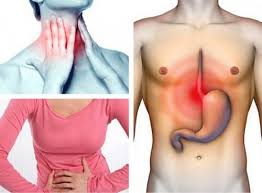 Pentru a atinge aceste obiective se aplica masuri generale si un tratament medicamentos specific. Cum PoÈi Afla DacÄ Suferi De Reflux Gastroesofagian Doza De SÄnÄtate