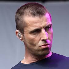 Liam Gallagher Needs Hair Transplant Says Expert Celebrity News Showbiz Tv Express Co Uk