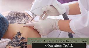 As tattoos have become increasingly popular, the requests for tattoo removal has also increased. Choosing A Laser Tattoo Removal Clinic 5 Questions To Ask Fresh Skin Canvas