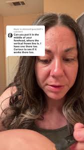 How to Use Peter Rothman Eye