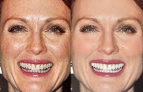 Image result for before and after photoshop
