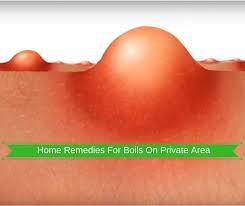 Pin On Remedies
