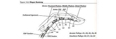 The three finger injuries that climbers frequently experience are an a2 pulley strain or rupture, a flexor tendon tear, or a collateral ligament strain. Finger Tendon Pulley Injury Training For Climbing By Eric Horst
