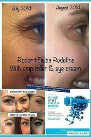 Does Rodan Fields Work Better Than Botox Reverse Regimen Before After Pictures Rodan And Fields Redefine Rodan And Fields Skin Care