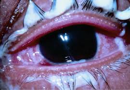 Image result for Gonococcal Conjunctivitis