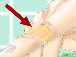 How To Treat A Paper Cut (With Pictures) - Wikihow