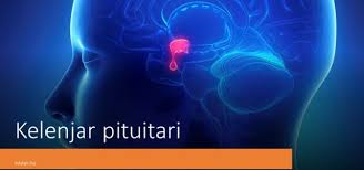 Hipopituitarisme merupakan kondisi di mana kelenjar pituitari mengalami kegagalan dalam memproduksi satu atau lebih hormon pituitari, atau tidak memproduksinya dalam jumlah cukup. Kelenjar Pituitari Adalah Letak Struktur Fungsi Penyakit Diulas Oleh Naisha Pratiwi Adalah Top
