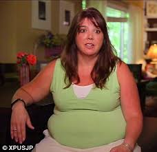 Download ssbbw juicy jackie try to workout in tight clothes. Jacqui Extreme Weight Loss Shaken Baby Syndrome