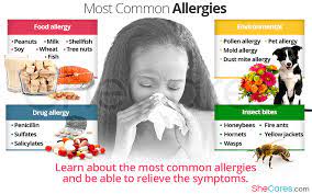 Most Common Allergies Symptoms And Solutions Shecares