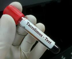 Image result for Tacrolimus