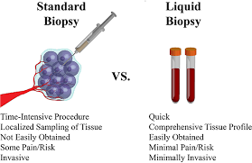 And the best tests for early. Liquid Biopsy Predicts Colon Cancer Recurrence