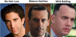 Early hair loss is a phenomena across the world and it's due to various factors. Is My Hairline Receding I Am Only 17 Years Old Is It Possible To Have Hair Loss At Such A Young Age Quora