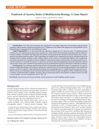 Gum gingivectomy or gum recontouring Pdf Treatment Of Gummy Smile Of Multifactorial Etiology A Case Report