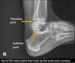 Image result for Talus