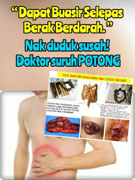 Atau saat bab feses atau tinja berwarna agak kehitaman? Dapat Buasir Selepas I Figure Cuci Usus Sembelit Facebook