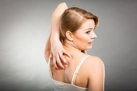 Image result for Notalgia Paresthetica