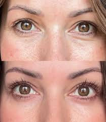 Best toxin free eye cream recommended