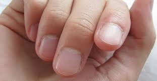 Maybe you would like to learn more about one of these? Por Que Aparecen Manchas Blancas En Las Unas Consumer