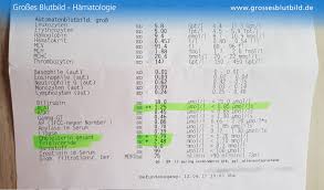 Grosses Blutbild Alle Werte Des Hamogramm Verstandlich Erklart Die rechte tabelle im beispiel zeigt ihnen schnell und übersichtlich den gesamtumsatz der einzelnen standorte an. grosses blutbild alle werte des