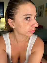 Götze Hospitals? I don't know to going with Serkan Gökpinar oder dr. Damla  🤔