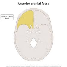 Anterior Cranial Fossa Radiology Reference Article Radiopaedia Org