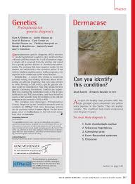The comedones are widened openings for hair follicles and sebaceous glands filled with material. Pdf Dermacase Can You Identify This Condition Favre Racouchot Syndrome