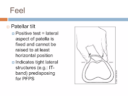 Image result for Patellar Tilt Test