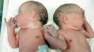 Ssw nun vom scheitel bis zur ferse und damit hat es schon eine beeindruckende größe erreicht. Entwicklung Zwillinge Im 7 Monat Ssw 26 Ssw 30 Babywelten Ch