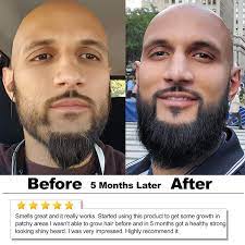 With low prices on millions of quality items, we don't fault you for wanting to shop online all the time. Buy Okay Men S Castor Oil Beard And Hair Growth Oil Lightweight For All Hair Types Textures Stimulates Hair Growth Readily Absorbed Free Of Silicone Paraben