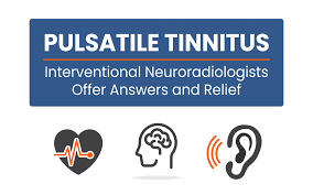 If earwax buildup or a sinus infection is the culprit, the tinnitus usually stops after removing the blockage or recovering from the. Pulsatile Tinnitus Interventional Neuroradiologists Offer Answers Relief