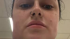 I paid £5,000 for liposuction to tackle my double chin