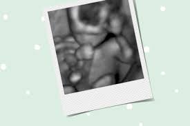 Das geschlecht des babys lässt sich im 4. 17 Ssw Schwangerschaftswoche Babygrosse Geschlecht Netdoktor At