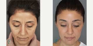 Kerem Sami Kaya, MD, Otolaryngologist