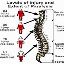 Pdf Bradycardia Secondary To Cervical Spinal Cord Injury