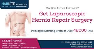 Get Laparoscopic Hernia Repair Surgery Hernia Repair Surgery Laparoscopic Surgery