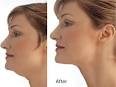 Comment perdre son double menton? - Magazine Avantages