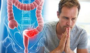 If you can't go or find that you're going unexpectedly, it could be a symptom of colon cancer. Bowel Cancer Symptoms And Signs Three Bowel And Toilet Habits That Indicate The Disease Express Co Uk